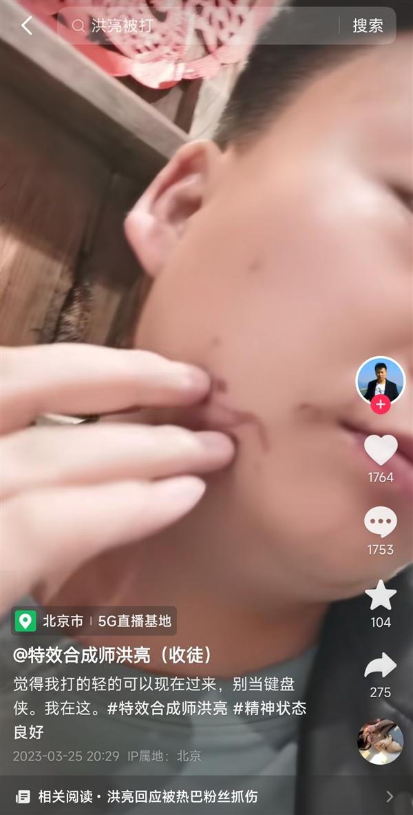 Case image 129 may not showing correctly because of your location.