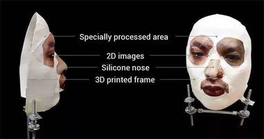 Case image 74 may not showing correctly because of your location.